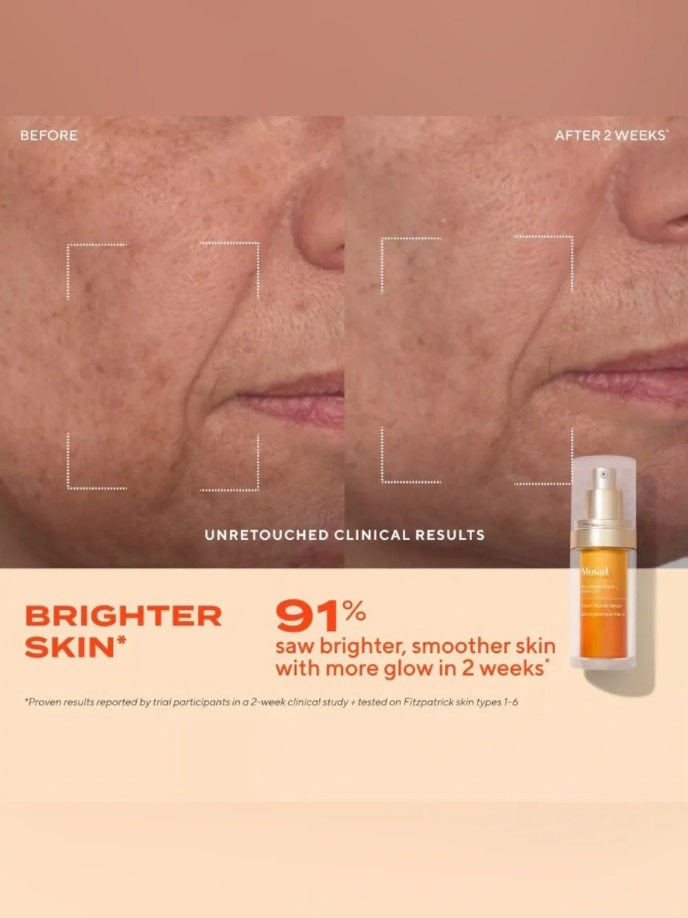 Murad dramatically brightens